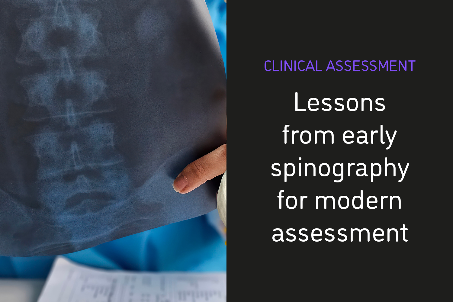 Precision Then and Now: What Early Spinography Teaches Us About Modern Assessment